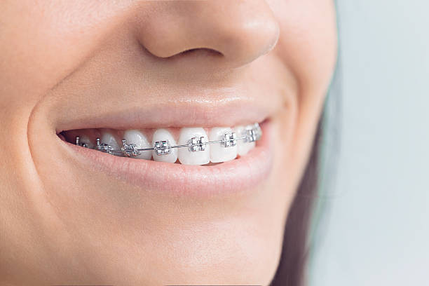 Best Veneers and Lumineers  in Tutwiler, MS